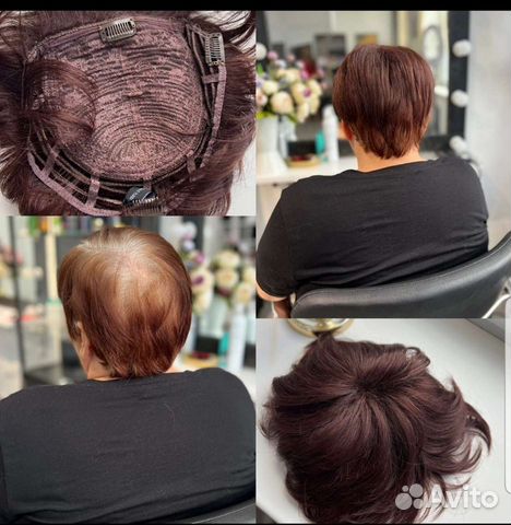 Накладка из термоволокна